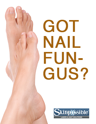 Nail-fungus-therapy-calgary