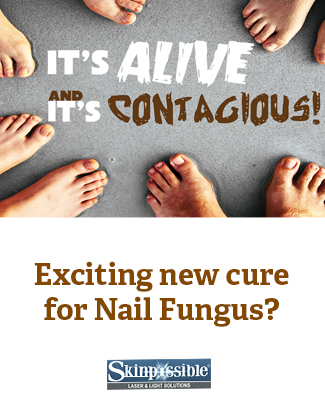 Nailfungus