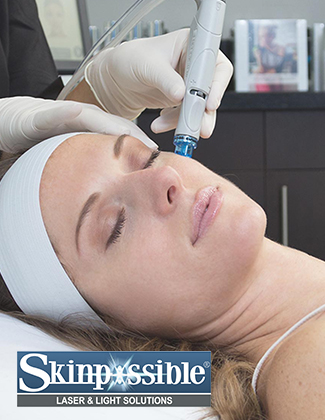 Hydrafacial-calgary