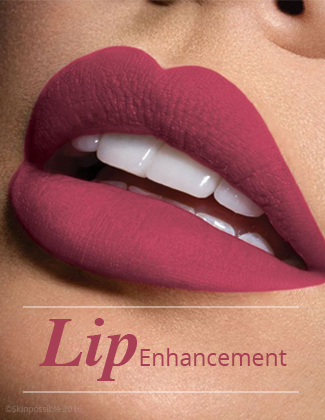 Lip-filler-calgary