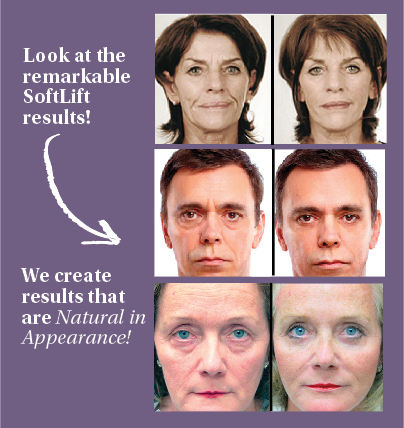 softlift-incalgary